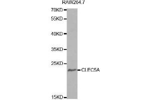 Western blot analysis of extracts of RAW264. (CLEC5A 抗体  (AA 29-188))