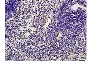 Immunohistochemistry (Paraffin-embedded Sections) (IHC (p)) image for anti-CD19 Molecule (CD19) (pTyr531) antibody (ABIN683623)