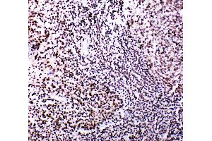 Anti-B MyB antibody, IHC(P) IHC(P): Human Tonsil Tissue (MYBL2 抗体  (N-Term))