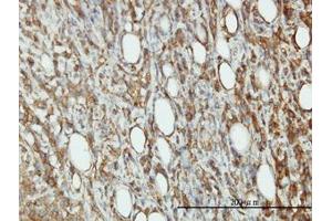 Image no. 3 for anti-Eukaryotic Translation Initiation Factor 5 (EIF5) (AA 1-432) antibody (ABIN598657) (EIF5 抗体  (AA 1-432))