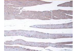Detection of CBR1 in Mouse Skeletal Muscle Tissue using Polyclonal Antibody to Carbonyl Reductase 1 (CBR1) (CBR1 抗体  (AA 66-271))