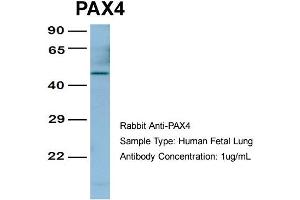 Host:  Rabbit  Target Name:  PAX4  Sample Type:  Human Fetal Lung  Antibody Dilution:  1. (PAX4 抗体  (Middle Region))