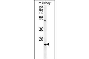Western blot analysis in mouse kidney tissue lysates (15ug/lane).