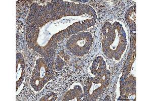 IHC analysis of TRMT61B using anti-TRMT61B antibody (ABIN7602334). (TRMT61B 抗体  (AA 7-477))