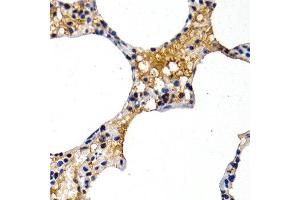 Immunohistochemistry of paraffin-embedded rat lung using MT2A antibody at dilution of 1:200 (400x lens).