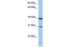 Western Blotting (WB) image for anti-JAZF Zinc Finger 1 (JAZF1) antibody (ABIN2458461) (JAZF1 抗体)