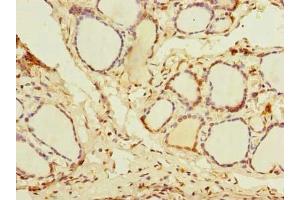 Immunohistochemistry of paraffin-embedded human thyroid tissue using ABIN7144994 at dilution of 1:100 (DDX5 抗体  (AA 1-210))