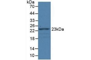 Detection of Recombinant FBLN1, Rat using Monoclonal Antibody to Fibulin 1 (FBLN1) (Fibulin 1 抗体)