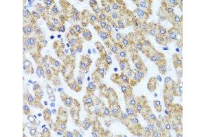 Immunohistochemistry of paraffin-embedded Human liver damage using INADL Polyclonal Antibody at dilution of 1:100 (40x lens). (PATJ 抗体)