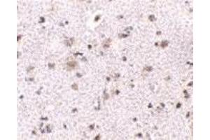 Immunohistochemistry (IHC) image for anti-Brain and Reproductive Organ-Expressed (TNFRSF1A Modulator) (BRE) (N-Term) antibody (ABIN1031282) (BRE 抗体  (N-Term))