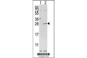 Western blot analysis of AK3 using rabbit polyclonal AK3 Antibody (C-term H38) using 293 cell lysates (2 ug/lane) either nontransfected (Lane 1) or transiently transfected with the AK3 gene (Lane 2). (Adenylate Kinase 3 抗体  (C-Term))