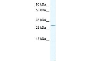 WB Suggested Anti-DMRT2 Antibody Titration:  2. (DMRT2 抗体  (C-Term))