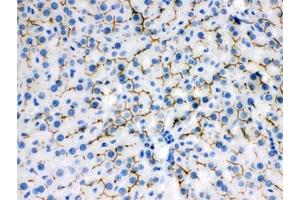 IHC testing of FFPE rat liver with ABCB11 antibody. (ABCB11 抗体)