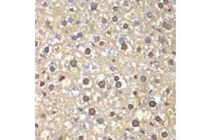 Immunohistochemistry of paraffin-embedded mouse liver using FEN1 antibody at dilution of 1:100 (400x lens). (FEN1 抗体)