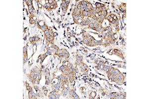 IHC analysis of NDUFAF1 using anti-NDUFAF1 antibody (ABIN7602459).