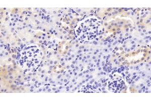 Immunohistochemistry (IHC) image for anti-Vav 1 Oncogene (VAV1) (AA 565-795) antibody (ABIN7444313)