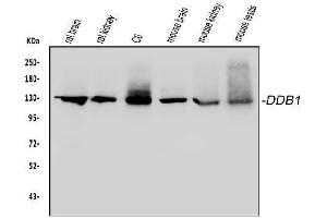 Western blot analysis of DDB1 using anti-DDB1 antibody (ABIN3043823).
