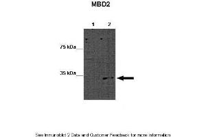 Lanes:   Lane 1: 15ug WT mouse ES lysate Lane 2: 15ug MBD2 KO mouse ES lysate  Primary Antibody Dilution:   1:1000  Secondary Antibody:   Goat anti-rabbit-HRP  Secondary Antibody Dilution:   1:2500  Gene Name:   MBD2 a  Submitted by:   Austin J. (MBD2 抗体  (Middle Region))