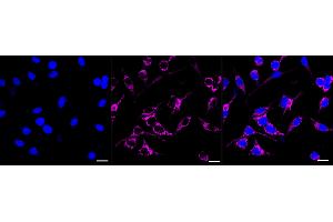 Immunocytochemical staining of HeLa cells with HHEX antibody (ABIN7798882), 1:1,000).