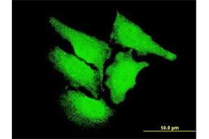 Immunofluorescence of monoclonal antibody to CAMK2D on HeLa cell. (CAMK2D 抗体  (AA 301-410))