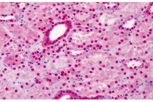 Human Kidney: Formalin-Fixed, Paraffin-Embedded (FFPE) (COPS5 抗体)
