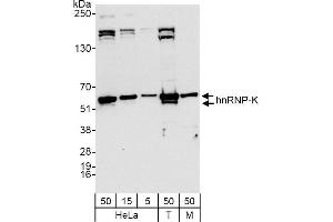 Western Blotting (WB) image for anti-Heterogeneous Nuclear Ribonucleoprotein K (HNRNPK) (AA 1-50) antibody (ABIN7454658)