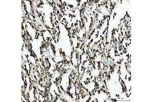 IHC analysis of SFPQ using anti-SFPQ antibody (ABIN7603089). (SFPQ 抗体  (Middle Region))