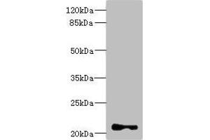 Western blot All lanes: TNNI2 antibody at 3. (TNNI2 抗体  (AA 1-100))