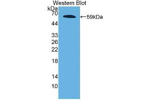 Western blot analysis of the recombinant protein. (Fibrillin 2 抗体  (AA 1550-1791))