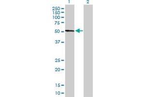 Western Blot analysis of CPB2 expression in transfected 293T cell line by CPB2 MaxPab polyclonal antibody. (CPB2 抗体  (AA 1-423))