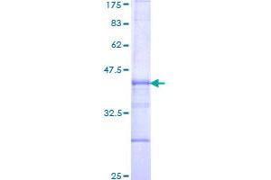 Image no. 1 for Integrin beta-6 (ITGB6) (AA 604-707) protein (GST tag) (ABIN1308221)