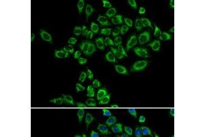 Immunofluorescence analysis of HeLa cells using SRPK1 Polyclonal Antibody (SRPK1 抗体)