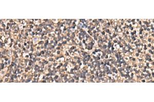 Immunohistochemistry of paraffin-embedded Human tonsil tissue using PLEKHF2 Polyclonal Antibody at dilution of 1:90(x200) (PLEKHF2 抗体)