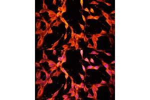 Immunofluorescence analysis of NIH/3T3 cells using MSP/MST1 antibody (ABIN6132374, ABIN6144095, ABIN6144096 and ABIN6216790) at dilution of 1:100. (MST1 抗体  (AA 200-500))
