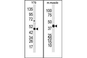 Image no. 1 for anti-Aldehyde Dehydrogenase 3 Family, Member A1 (ALDH3A1) (Middle Region) antibody (ABIN360203) (ALDH3A1 抗体  (Middle Region))