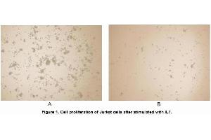 IL16 Protein (AA 1203-1332) (His tag)
