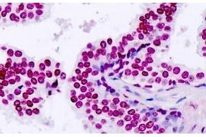 Human, Prostate: Formalin-Fixed Paraffin-Embedded (FFPE) (TARSL2 抗体  (AA 644-674))