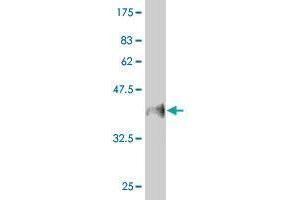 Western Blot detection against Immunogen (37. (MUC5B 抗体  (AA 4186-4295))