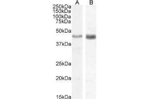 Western Blotting (WB) image for anti-Actin, alpha 2, Smooth Muscle, Aorta (ACTA2) (N-Term) antibody (ABIN185271)
