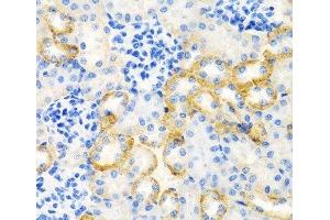 Immunohistochemistry of paraffin-embedded Rat kidney using STC1 Polyclonal Antibody at dilution of 1:100 (40x lens). (Stanniocalcin 1 抗体)
