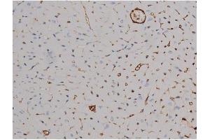 Immunohistochemistry (IHC) image for anti-Signal Transducer and Activator of Transcription 6, Interleukin-4 Induced (STAT6) (pThr645) antibody (ABIN6255720)