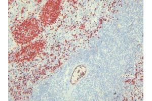 Immunohistochemistry (IHC) image for anti-Endothelial Cells antibody (ABIN781798) (Endothelial Cells 抗体)