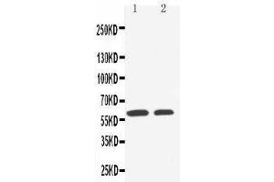 Anti-SLC22A1 antibody, Western blotting Lane 1: HELA Cell Lysate Lane 2: A549 Cell Lysate (SLC22A1 抗体  (C-Term))