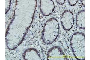 Image no. 1 for anti-Phosphoglucomutase 3 (PGM3) (AA 1-543) antibody (ABIN598868) (Phosphoglucomutase 3 抗体  (AA 1-543))