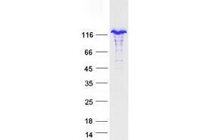 Validation with Western Blot