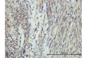 Image no. 1 for anti-Dynamin 1-Like (DNM1L) (AA 1-711) antibody (ABIN599113) (Dynamin 1-Like 抗体  (AA 1-711))
