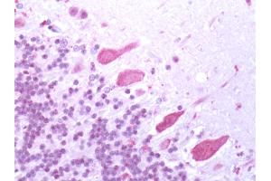 Human Brain, Cerebellum: Formalin-Fixed, Paraffin-Embedded (FFPE) (Bestrophin 3 抗体  (Cytoplasmic Domain))