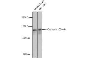 Western blot analysis of extracts of various cell lines, using K-Cadherin (CDH6) Rabbit mAb (ABIN1680831, ABIN3019147, ABIN3019148 and ABIN7101722) at 1:3000 dilution.