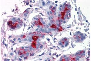 Breast, Human: Formalin-Fixed, Paraffin-Embedded (FFPE) (MUC1 抗体)