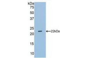 Western blot analysis of recombinant Human DUSP3. (Dual Specificity Phosphatase 3 (DUSP3) (AA 2-185) 抗体)